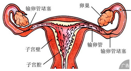 子宫性不孕严重危害女性健康